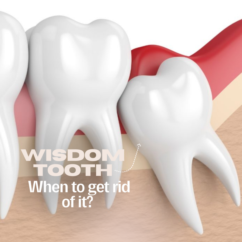 Winner Tooth Services - Brushmore Family & Cosmetic Dentistry